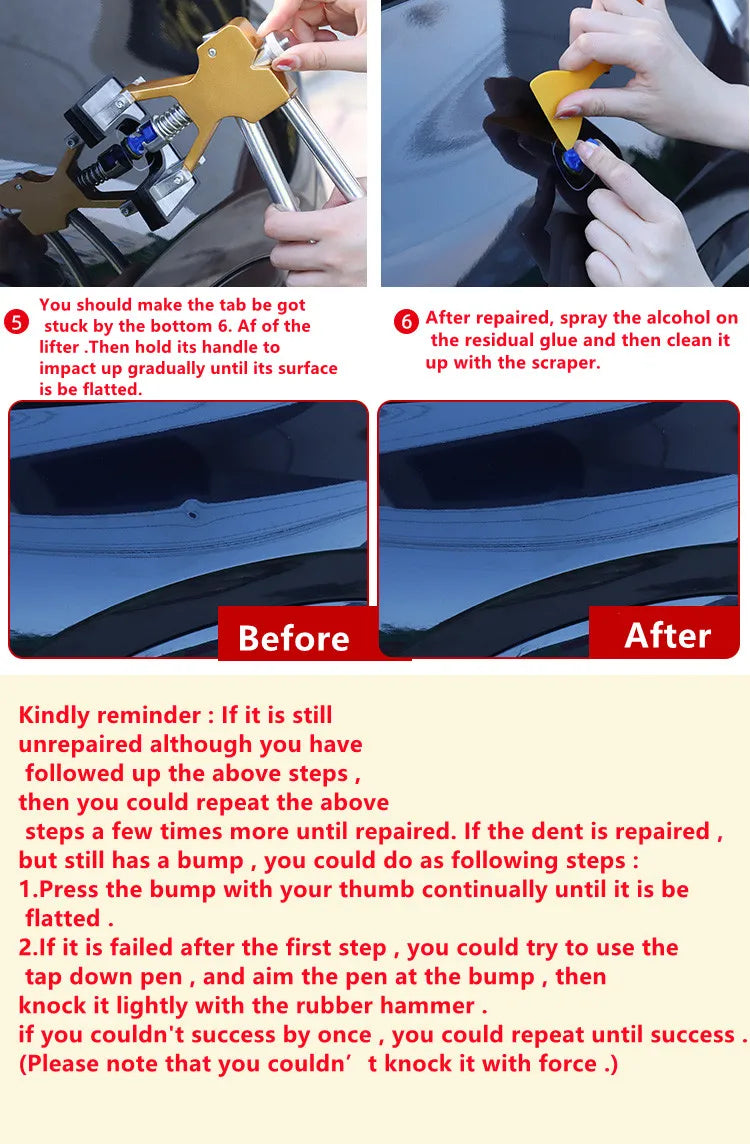 Paintless Dent Repair Puller Kit – Car Body Hail Dent Removal Suction Cup Tool Set